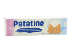 Patatine N1