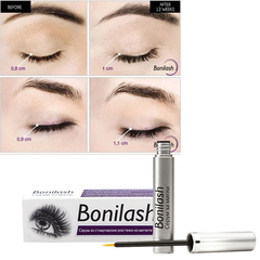 Bonilash ser pentru gene N1
